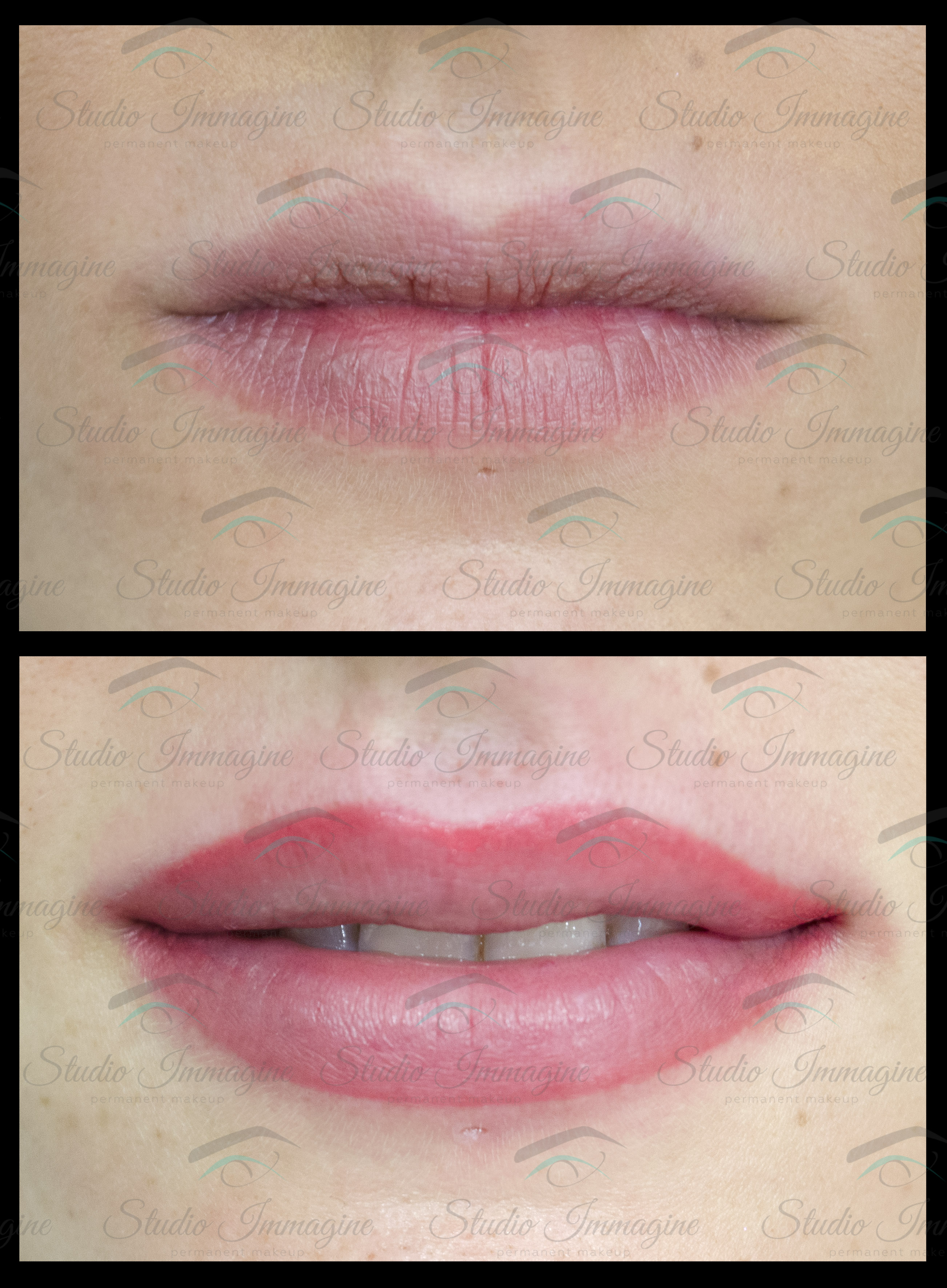 Trucco Permanente Labbra Studio Immagine Permanent Makeup